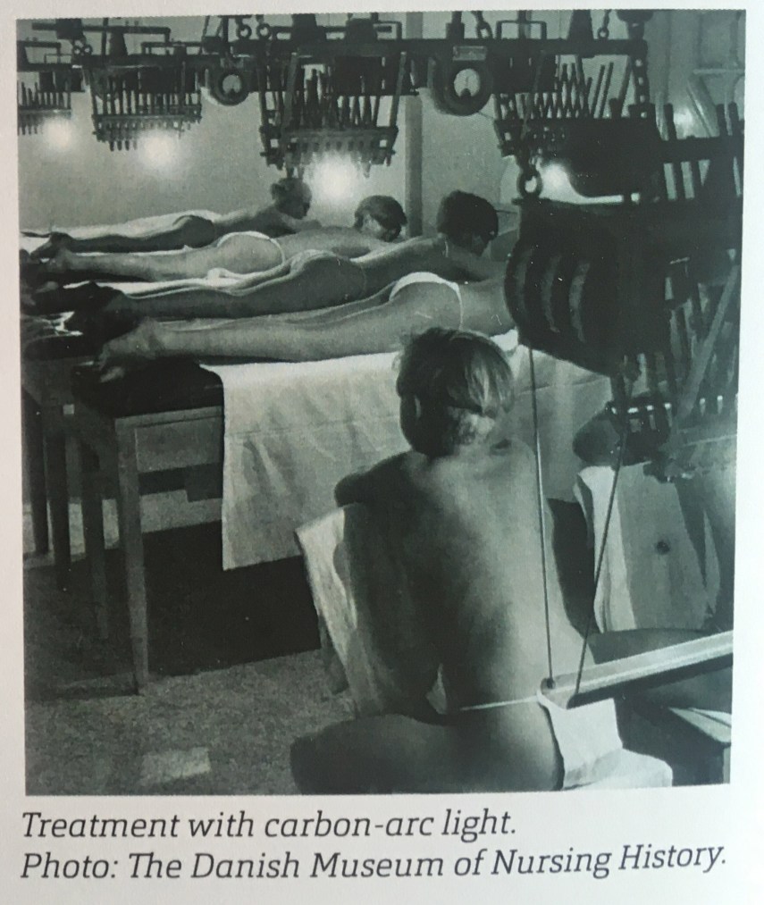 Treatment with carbon-arc light for two hours three times a week